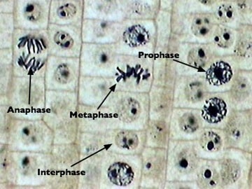 Root Tip Mitosis