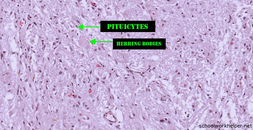 pdf morphogenesis of thyroid follicles in vitro 1976