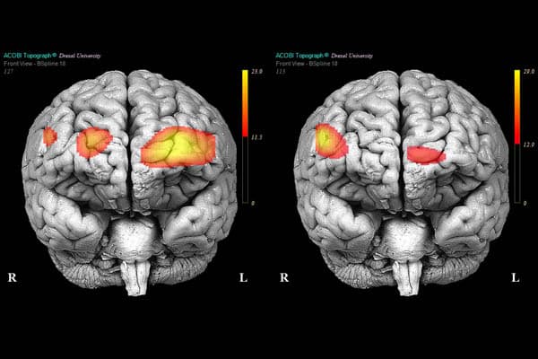 case studies of paranoid personality disorder