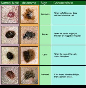 Skin Cancer: Basal Cell Carcinoma, Squamous Cell Carcinoma, Malignant ...