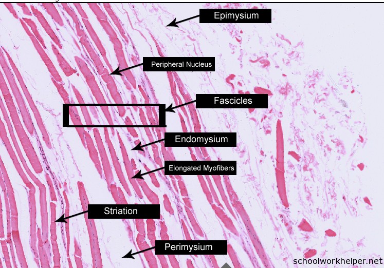 Skeletal Muscle Histology Slide Identification And Labeled Diagram ...