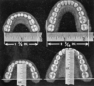 Dental-Diagram_Queensland-State-Archives